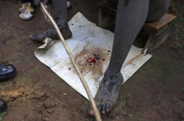 “割礼”是什么意思(非洲为什么要女性割礼割的是什么)